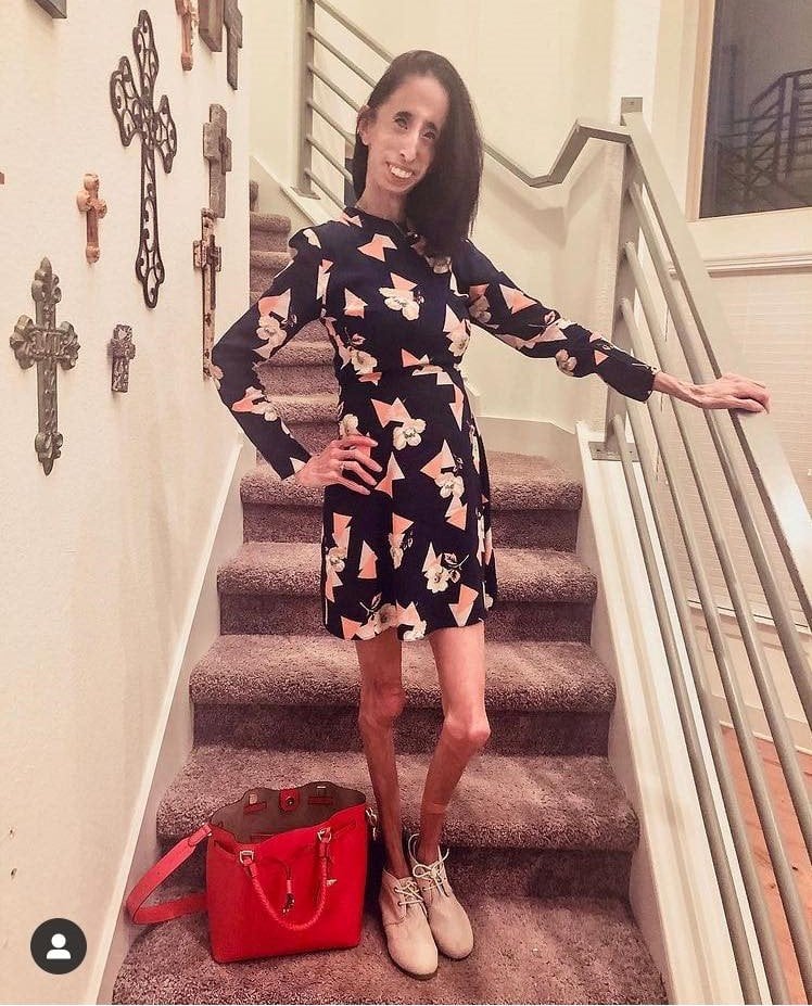 នាង&nbsp;Lizzie Velasquez