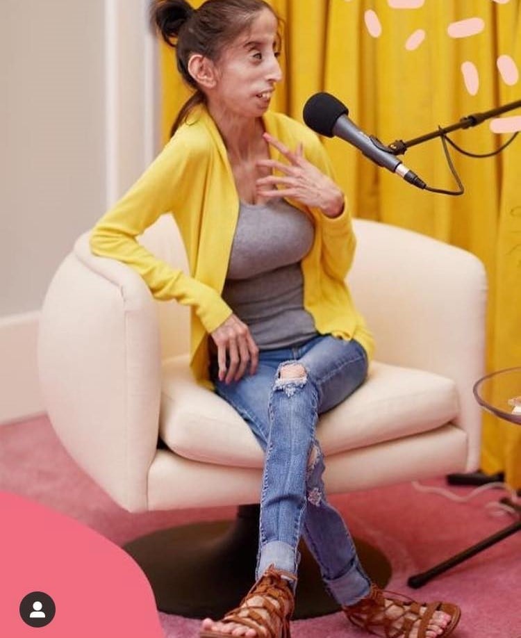 នាង Lizzie Velasquez