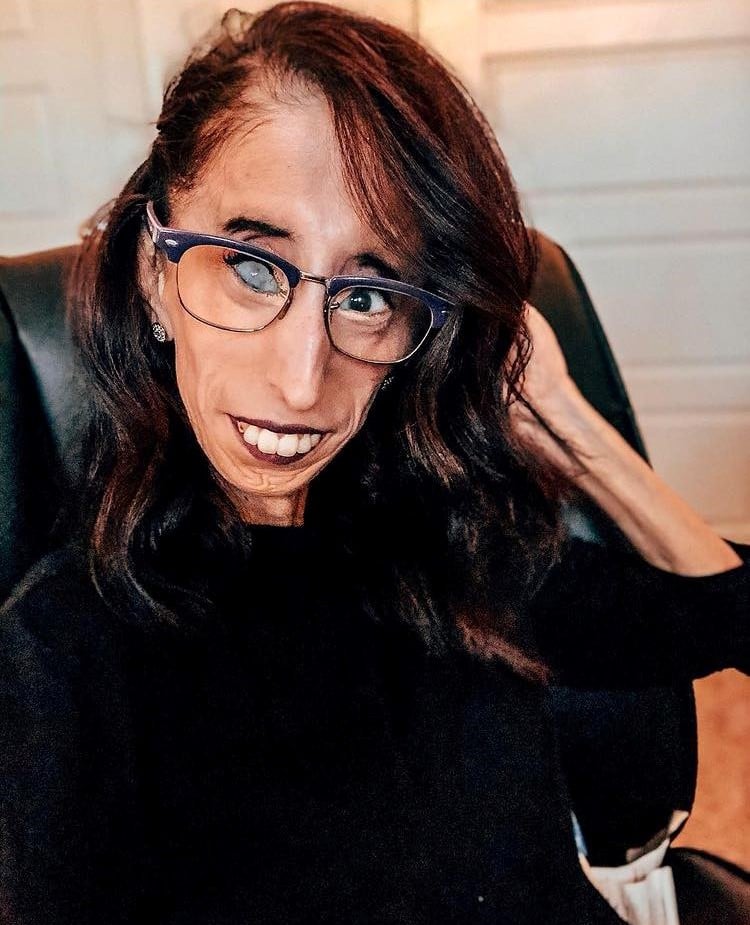 នាង Lizzie Velasquez