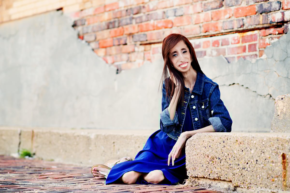 នាង Lizzie Velasquez