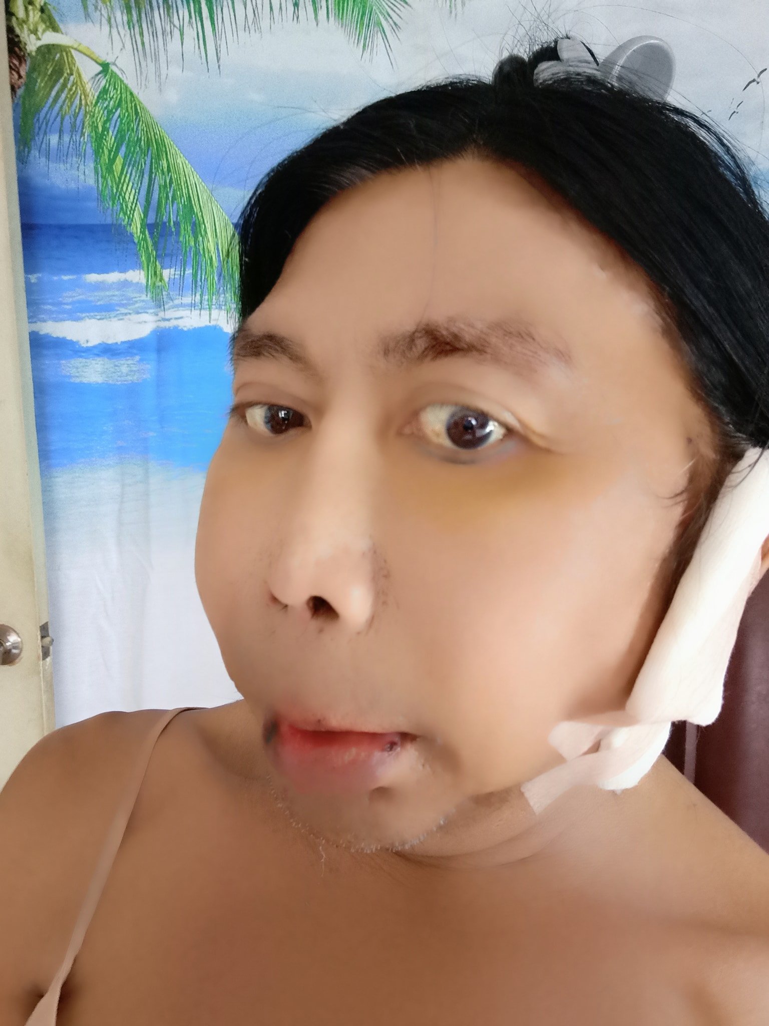រូបភាព Sitang ក្រោយពីកែសម្ផស្ស