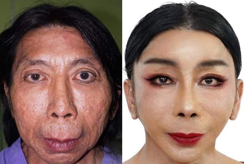 រូបភាពមុននិងក្រោយកែ របស់ Sitang