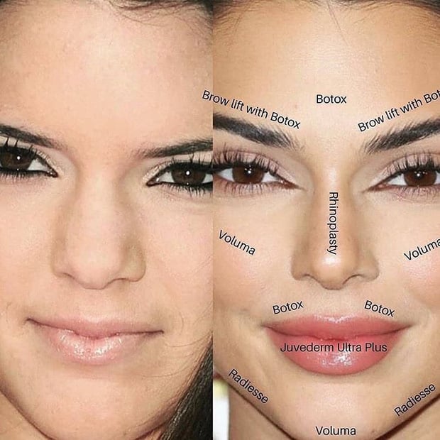 Kendall Jenner