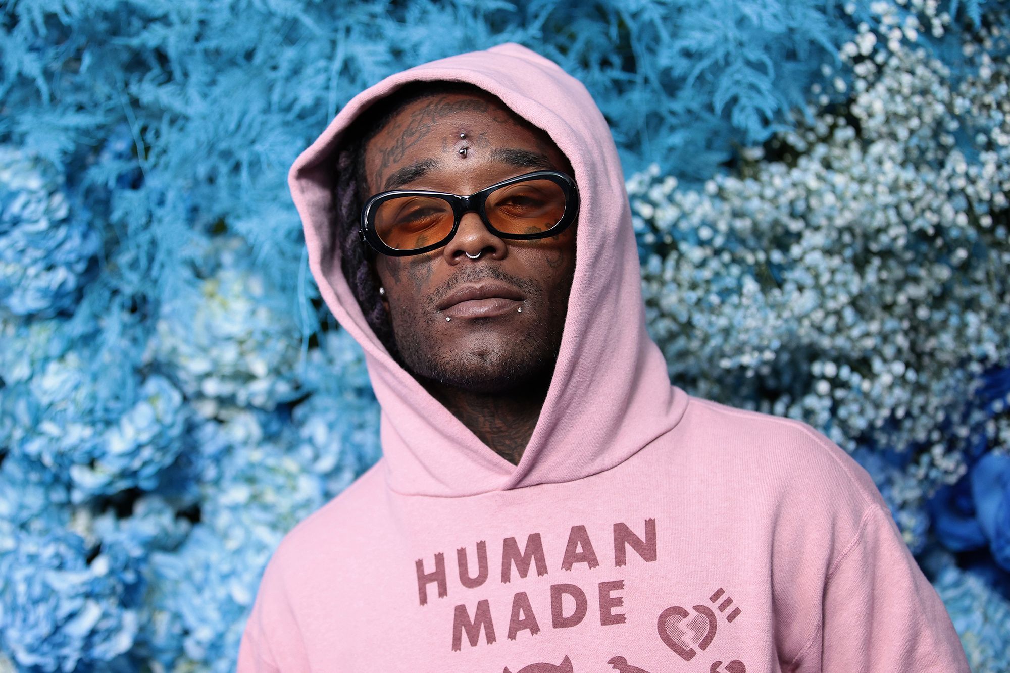 Lil Uzi Vert ក្រោយយកត្បូងចេញពីថ្ងាស