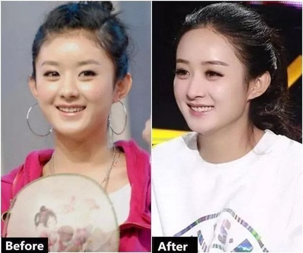 Zhao Liying&nbsp;