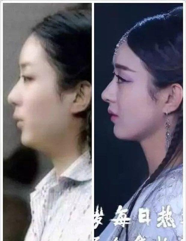 Zhao Liying&nbsp;