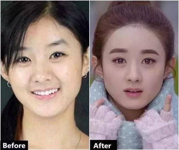 Zhao Liying&nbsp;