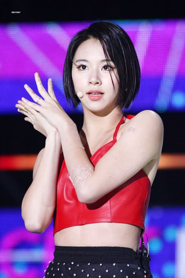 Chaeyoung បិទបាំងស្នាមសាក់របស់នាង&nbsp;