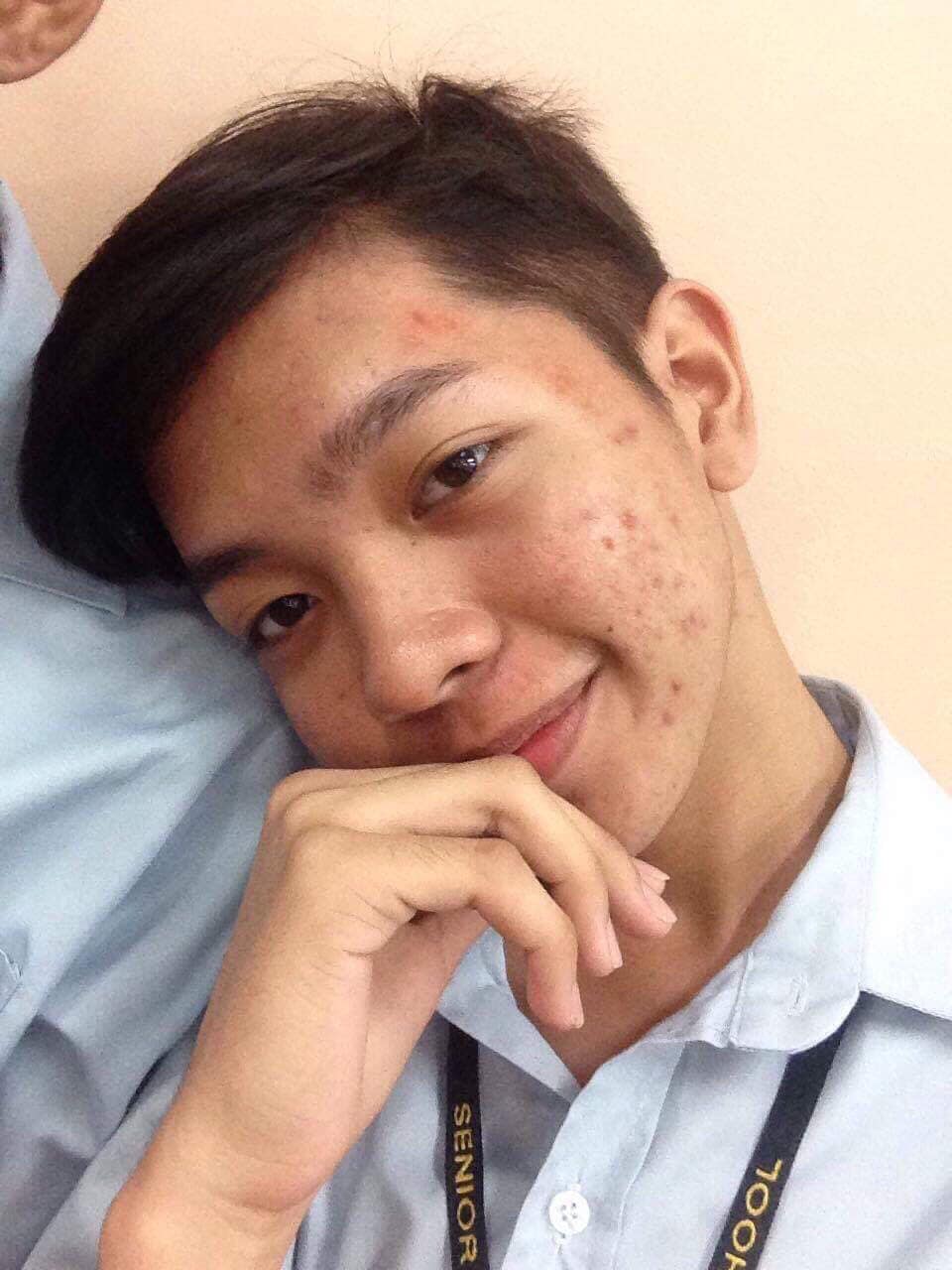 Ryan Zandy Acuin (មុនតែងស្រី)