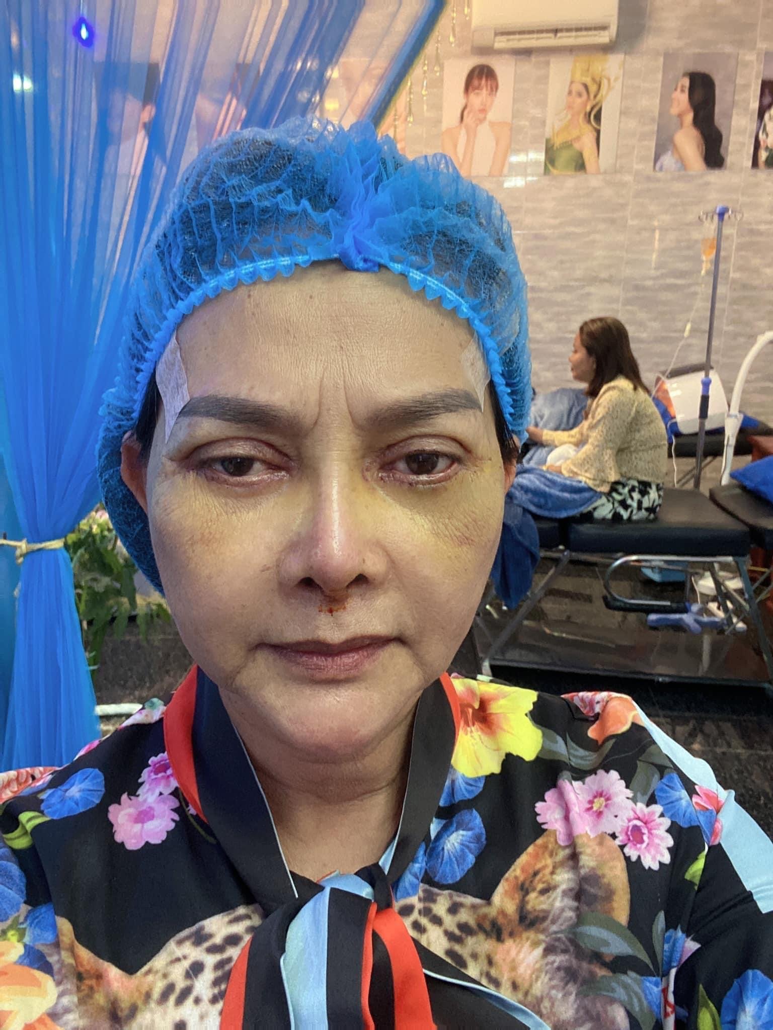 អ្នកនាង គ្រត