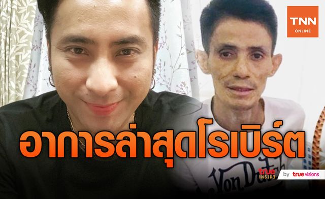 หายห่วง "บอล เชิญยิ้ม" อัพเดตอาการ "โรเบิร์ต สายควัน" บอกดีวัน ดีคืน