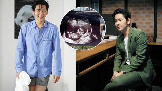 ข่าวดีรัวๆ โต๋ เผยภาพอัลตราซาวด์ บอย คอมเมนต์แป้นพิมพ์ผมลั่นเลย