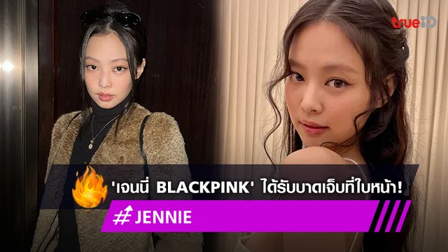'เจนนี่ BLACKPINK' แจ้งข่าวได้รับบาดเจ็บที่ใบหน้า ขอแฟนๆ ไม่ต้องเป็นกังวล