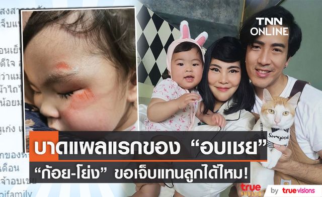 "ก้อย-โย่ง" สงสารลูกจับใจ "น้องอบเชย" ล้มหน้าไถล!!