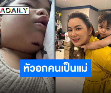 เจ็บตัวเข้าซะแล้ว “แม่บุ๋ม” อัปเดตอาการ “น้องอเล็กซ์” หลังคางแตกเย็บหลายเข็ม