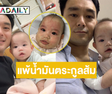 ลูกชายดารายุค90 ป่วยโรคชื่อประหลาด “แพ้น้ำมันตระกูลส้ม”