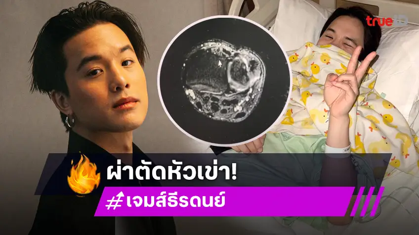 หยุดที่ผ่า! “เจมส์ ธีรดนย์” เข้าผ่าตัดเส้นเอ็นฉีก