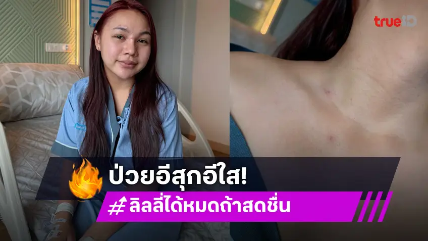 “ลิลลี่” ยกเลิกงาน เหตุป่วยอีสุกอีใส
