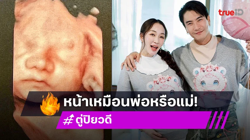 หน้าเหมือนใคร? ตู่ ปิยวดี เปิดภาพอัลตร้าซาวด์ เผยโฉมลูกสาววัย37สัปดาห์