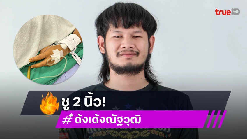 ด้งเด้ง หรือ จ่าลอด ไทบ้าน ชู2นิ้วส่งสัญญาณ แต่ยังน่าห่วง เสี่ยงติดเชื้อหลังผ่าตัด