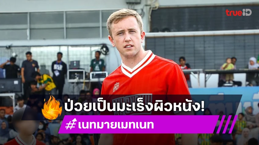 ส่งกำลังใจ! ยูทูบเบอร์หนุ่มป่วยเป็นมะเร็งผิวหนัง ต้องผ่าตัด