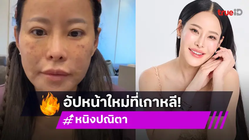 "หนิง ปณิตา" บุกเกาหลีเสริมสวย พร้อมเผยเคล็ดลับ หน้ายุบบวมอย่างไว!
