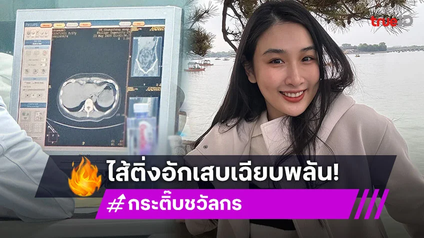 ไส้ติ่งอักเสบเฉียบพลัน! กระติ๊บ ชวัลกร ต้องเข้ารพ.ฉุกเฉินที่เซี่ยงไฮ้ สุดอึ้ง!ค่ารักษา