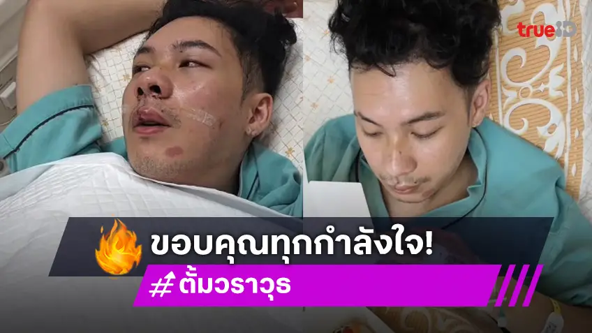 ความรู้สึก "ตั้ม วราวุธ" หลังประสบอุบัติ ขอบคุณทุกกำลังใจ พิมพ์ไปน้ำตาซึมไป