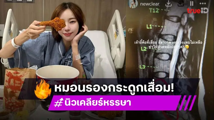 แอดมิทด่วน! นิวเคลียร์ หรรษา หมอนรองกระดูกเสื่อม โชคดีไม่ทับเส้นประสาท