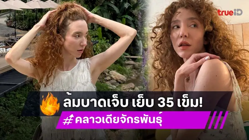 เจ็บแต่ไหว! “คลาวเดีย” ประสบอุบัติเหตุ วูบล้มหัวฟาด! เย็บ 35 เข็ม