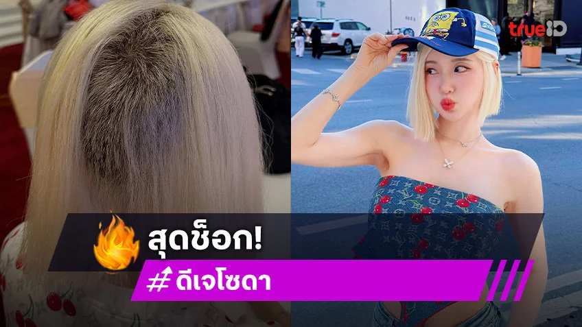 "ดีเจโซดา" ผมเสียหลังฟอกสีผมถึงขั้นต้องยอมโกนหัว