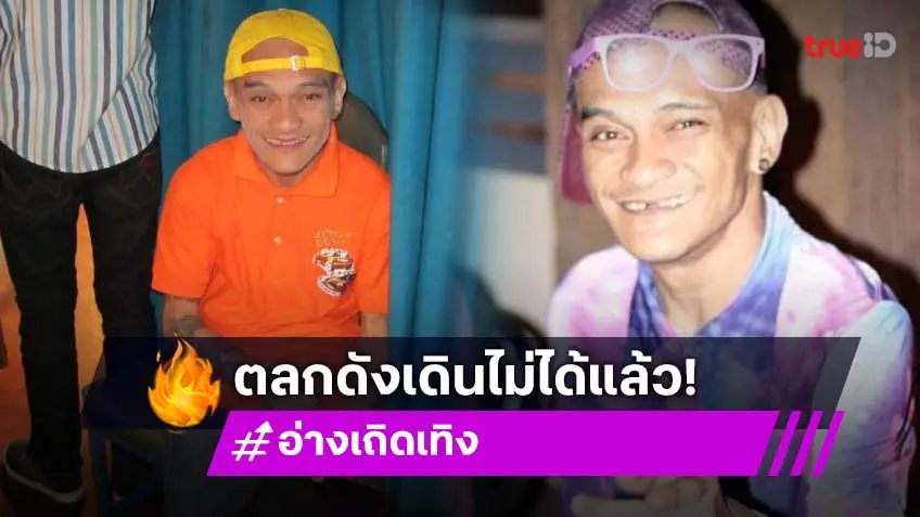 โต้ข่าวลือเสียชีวิต!!ตลกดังเดินไม่ได้แล้ว