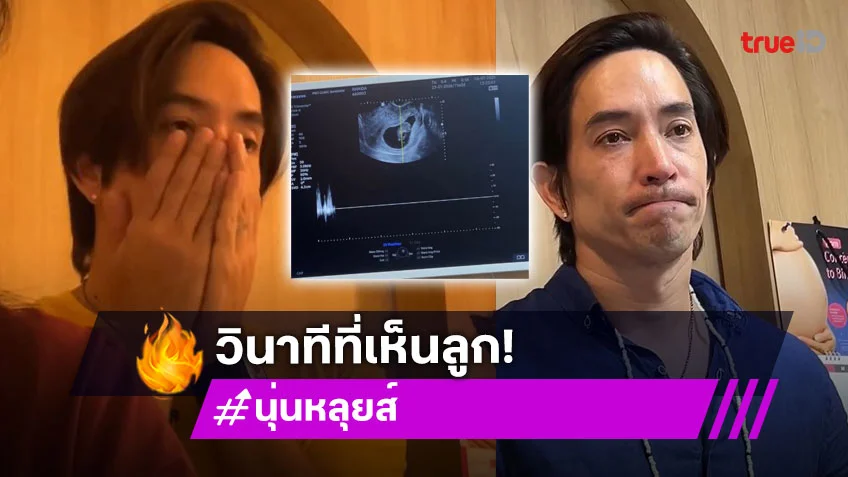 เปิดวินาที “หลุยส์ สก๊อต” ดูอัลตราซาวด์ลูกน้อยในครรภ์ “นุ่น รมิดา” ทำน้ำตาซึม!