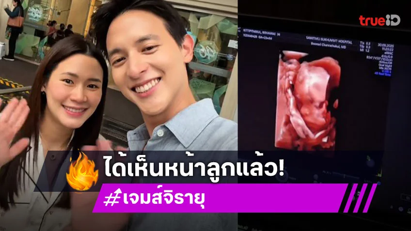 “เจมส์ จิรายุ” อัปเดต “โฟม” ท้อง 23 สัปดาห์ น้ำหนักขึ้น 10 กิโล พร้อมโชว์ภาพอัลตร้าซาวด์ลูกแบบ 3D