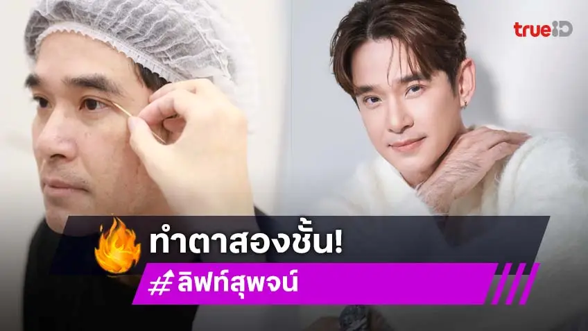 "ลิฟท์ สุพจน์" เผยความหล่อใส ๆ หลังทำตาสองชั้น "ลิฟท์ สุพจน์" เผยความหล่อใส ๆ หลังทำตาสองชั้น