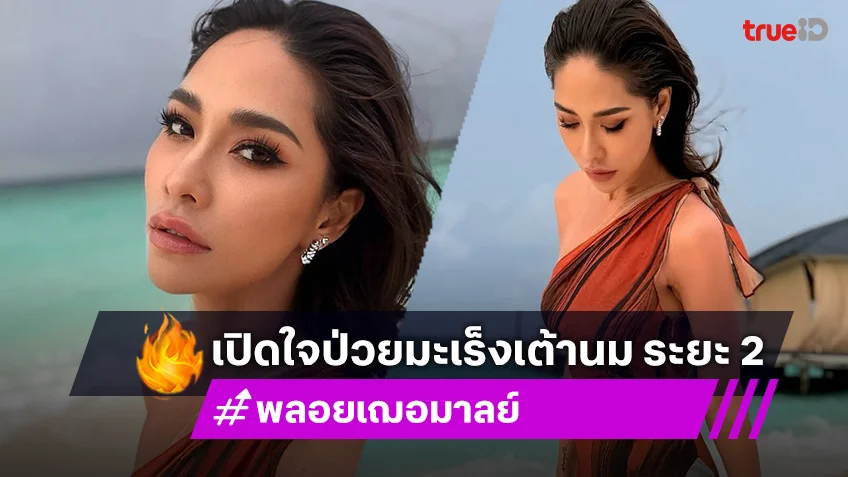 พลอย เฌอมาลย์ เผยเป็นมะเร็งเต้านมระยะ 2 ผ่านรายการ Sisterhood