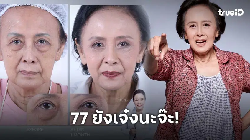 77 ยังเด็ดนะจ๊ะ! "หน่อย ณัฐนี" นักแสดงรุ่นใหญ่เจ้าแม่ผีปอบ โชว์ภาพล่าสุดหลังทำศัลยกรรมตัดถุงใต้ตา