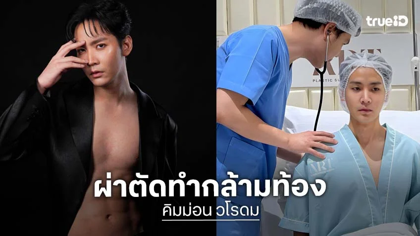 "คิมม่อน วโรดม" ผ่าตัดศัลยกรรมกล้ามท้อง พร้อมแจกความแซ่บ!