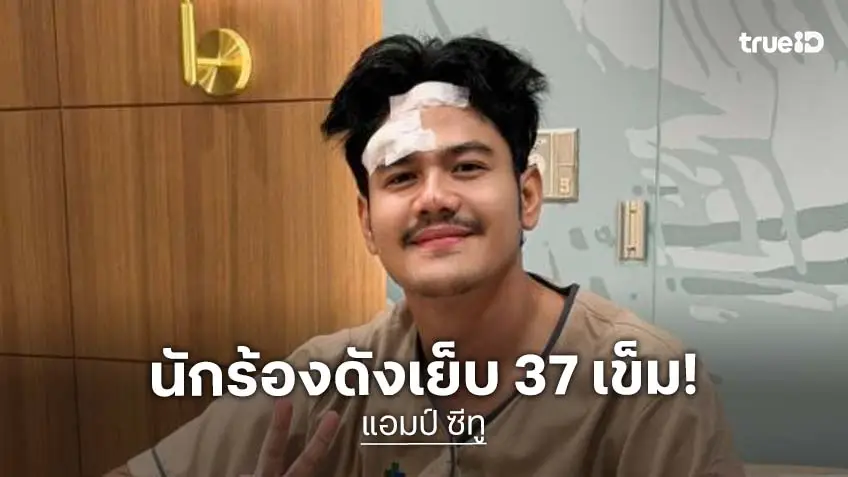 นักร้องดังเดินชนกระจกต้องเย็บ 37 เข็ม