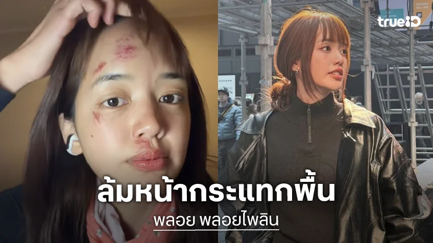 ยูทูบเบอร์ดัง ประสบอุบัติเหตุล้มหน้ากระแทกพื้น