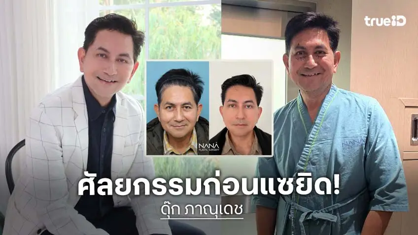"ดุ๊ก ภาณุเดช" ศัลยกรรมยกหน้าก่อนแซยิด คนทักหน้าเด็กลง 10 ปี