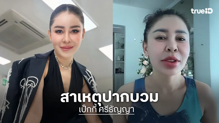 “เป็กกี้ ศรีธัญญา” ปากบวมเป่ง พร้อมเผยสาเหตุ!!