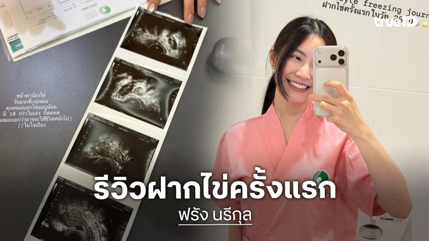 “ฟรัง นรีกุล” รีวิวฝากไข่ครั้งแรกในวัย 28 ปี