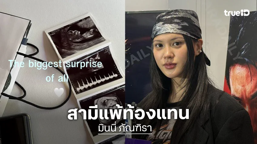 “มินนี่ ภัณฑิรา” เผยท้องลูกคนแรก 3 เดือน สามีแพ้ท้องแทนจนต้องไปสแกนสมอง
