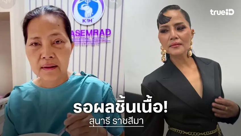 แฟนคลับแห่ส่งกำลังใจ "สุนารี ราชสีมา" ส่องกล้องลำไส้ ตัดชิ้นเนื้อส่งตรวจ รอผล 1 สัปดาห์