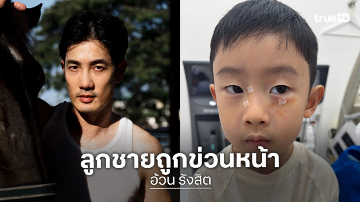 “อ้วน รังสิต” จุกอก! ลูกชาย “น้องโรฮา” ถูกเด็กข่วนหน้าในสวนสนุก