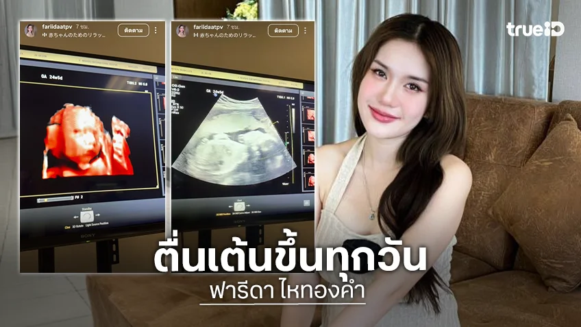 มาแล้ว! ภาพอัลตร้าซาวด์ลูกสาว “ฟารีดา” อายุครรภ์ 24 สัปดาห์ โครงหน้าชัด แก้มยุ้ย-จมูกโด่ง