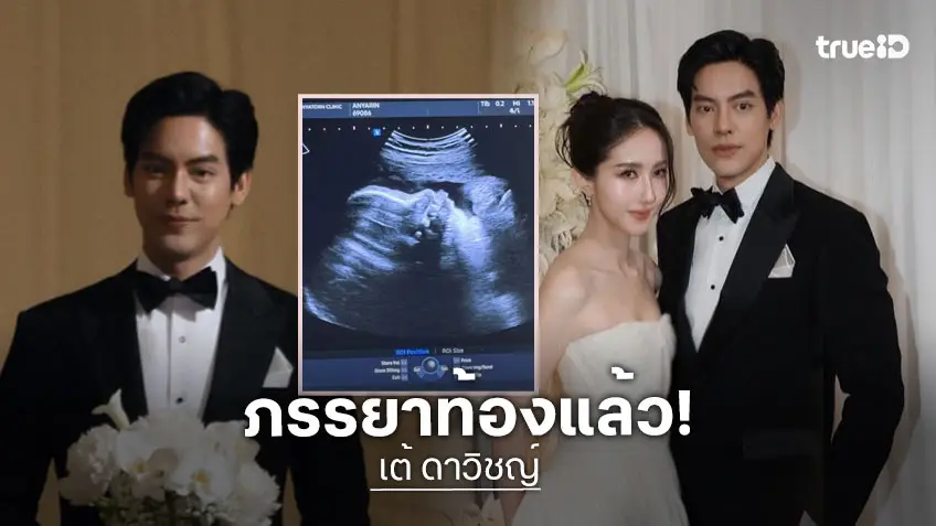 “เต้ ดาวิชญ์” ประกาศข่าวดีภรรยาท้องลูกคนแรกแล้ว คุณได้ลูกสาว!