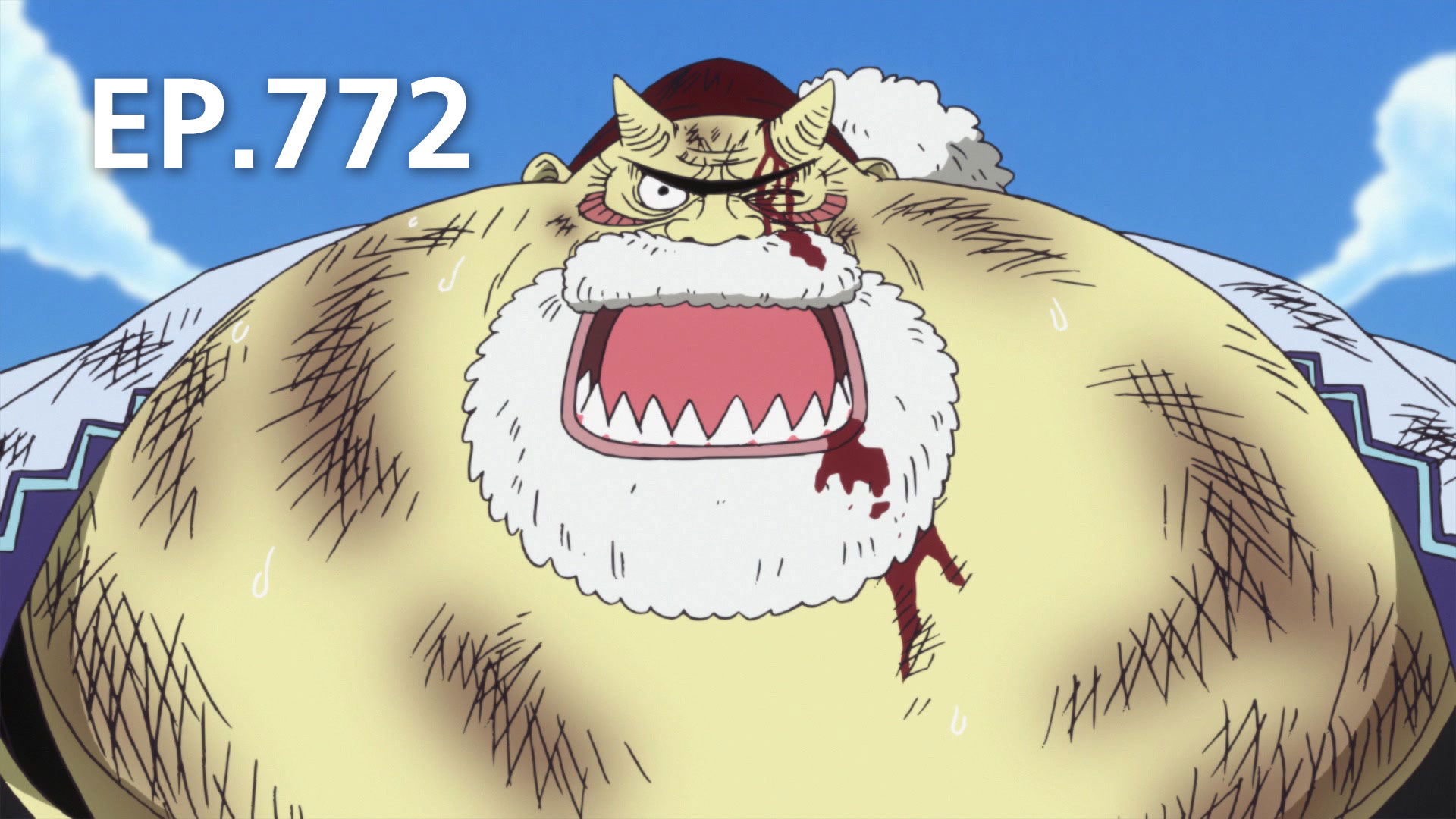 ep-772-18