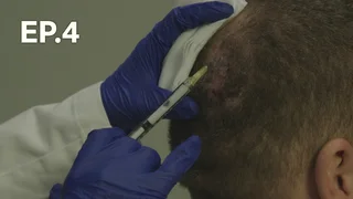 EP.04 | Embarrassing Bodies UK S8